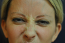 Botox