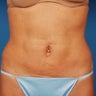 40 - 50 Year Old Female