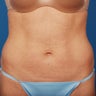 40 - 50 Year Old Female