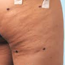 Cellulaze