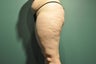 Cellulaze