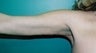 38 year old female patient