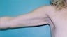 38 year old female patient