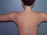 42 year old female patient