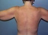 42 year old female patient