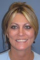 Face Lift/ Lite Lift