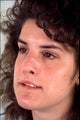 Revision rhinoplasty