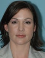 Young female underwent a 12 minute closed tip Rhinoplasty