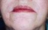 62 year old female patient