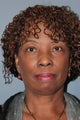 LiteLift™ on 65-year-old Woman