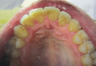 Treating an International patient