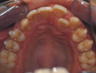 Treating an International patient