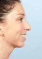 Woman Treated for Weak Chin