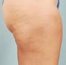 Cellulaze