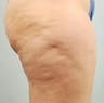 Cellulaze