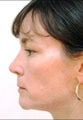 Short, projecting nose
