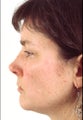 Short, projecting nose