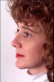 Rhinoplasty