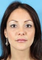 Botox and Fillers (Restylane and Juvederm)