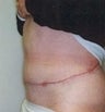 55 year old female patient