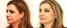 Fat transfer with a facelift
