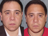 Revision Rhinoplasty