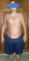 26 Year old male Sever Obesity