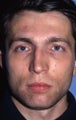 Revision Rhinoplasty