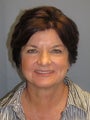 LiteLift™, Blepharoplasty, Temple Brow Lift on 62-year-old Woman
