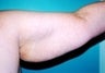 55 year old female patient