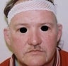 Male patient who underwent ear surgery
