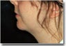 Face and Neck