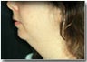 Face and Neck