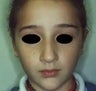 6 year old female patient