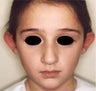 6 year old female patient