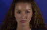 Revision Rhinoplasty