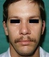 32 year old male patient