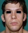 32 year old male patient