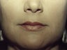 Lips