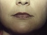 Lips