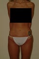lax thigh and buttocks