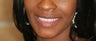 32 year old female treated with All-on-4 Dental Implant Procedure
