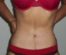 Complete Body Makeover