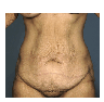 Complete Body Makeover