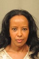 56 Year Old Female Treated for Undereye Bags