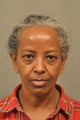 56 Year Old Female Treated for Undereye Bags