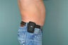 Liposuction