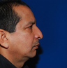 Rhinoplasty