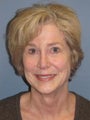 LiteLift™ on 59 year old Woman