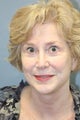 LiteLift™ on 59 year old Woman